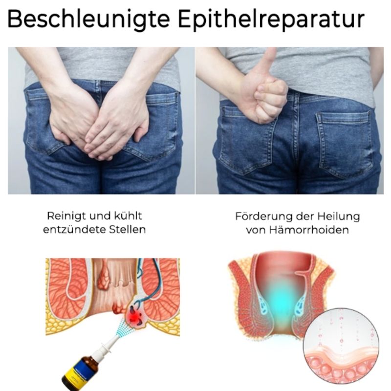 HämorrHeil™ | Hämorrhoiden Kräuterspray
