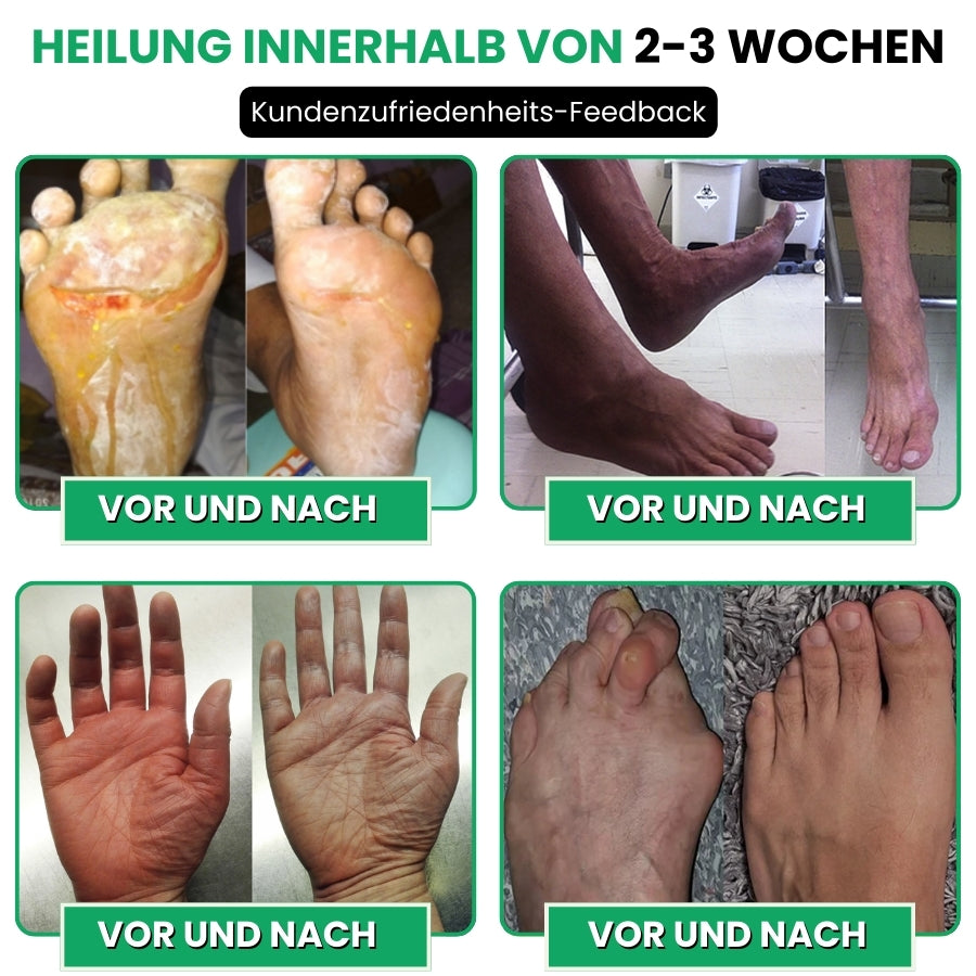 NerveFlex™ | Anti-Neuropathie-Gerät