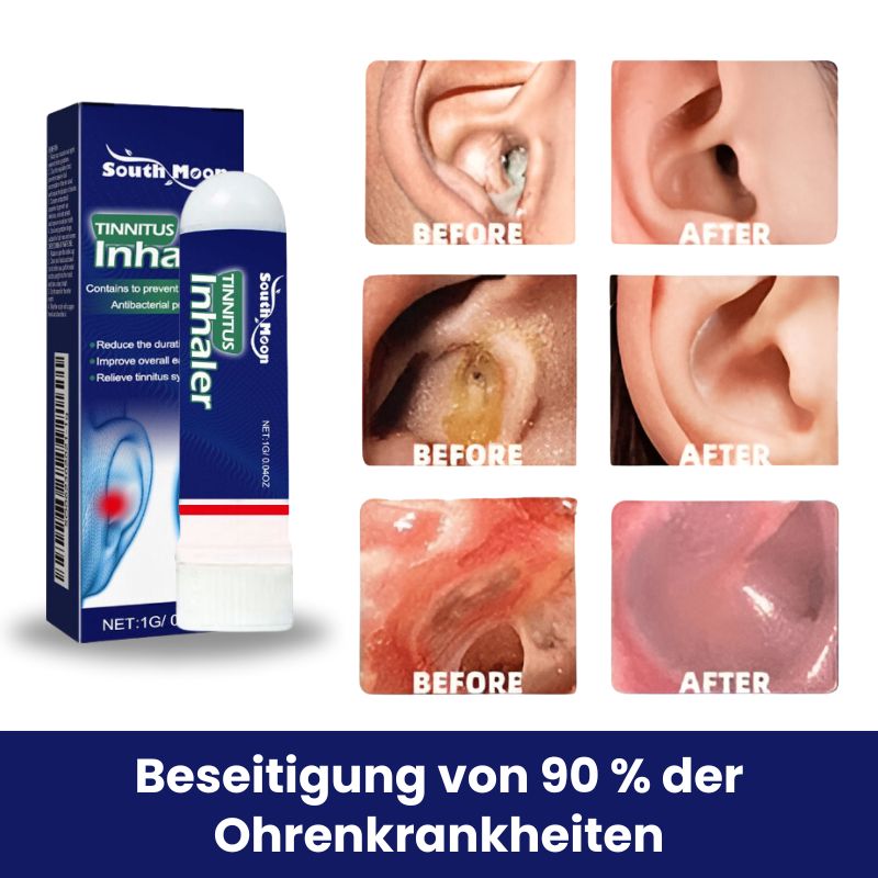 EchoStille™ | Sofortiger Tinnitus-Linderung Nasen-Inhalator
