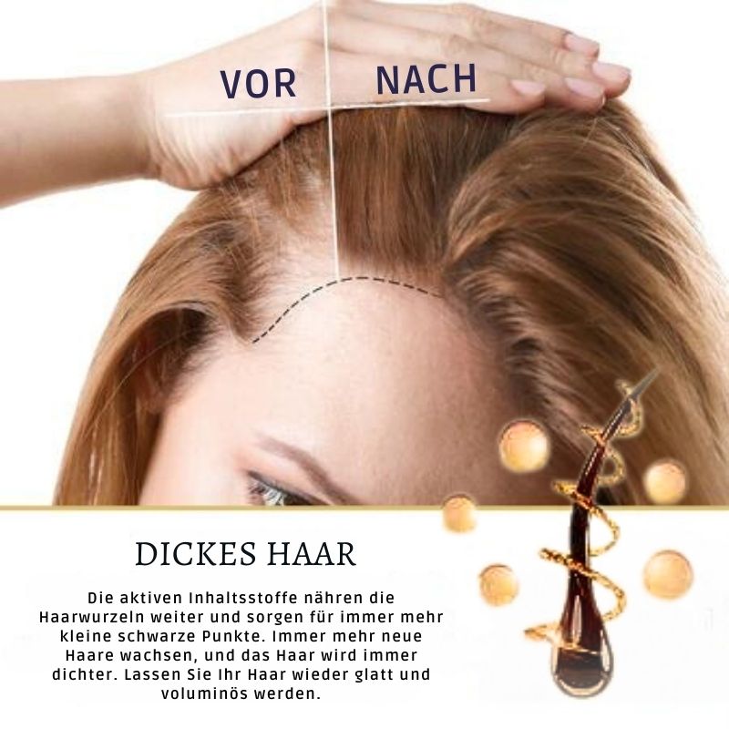WachsenMax™ | Haarwachstumsserum