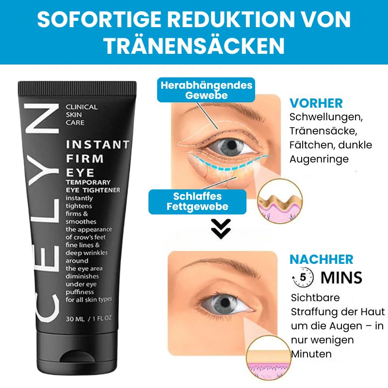 EyeFirm™ - Creme | Reduziert Schwellungen und Fältchen in 5 Minuten