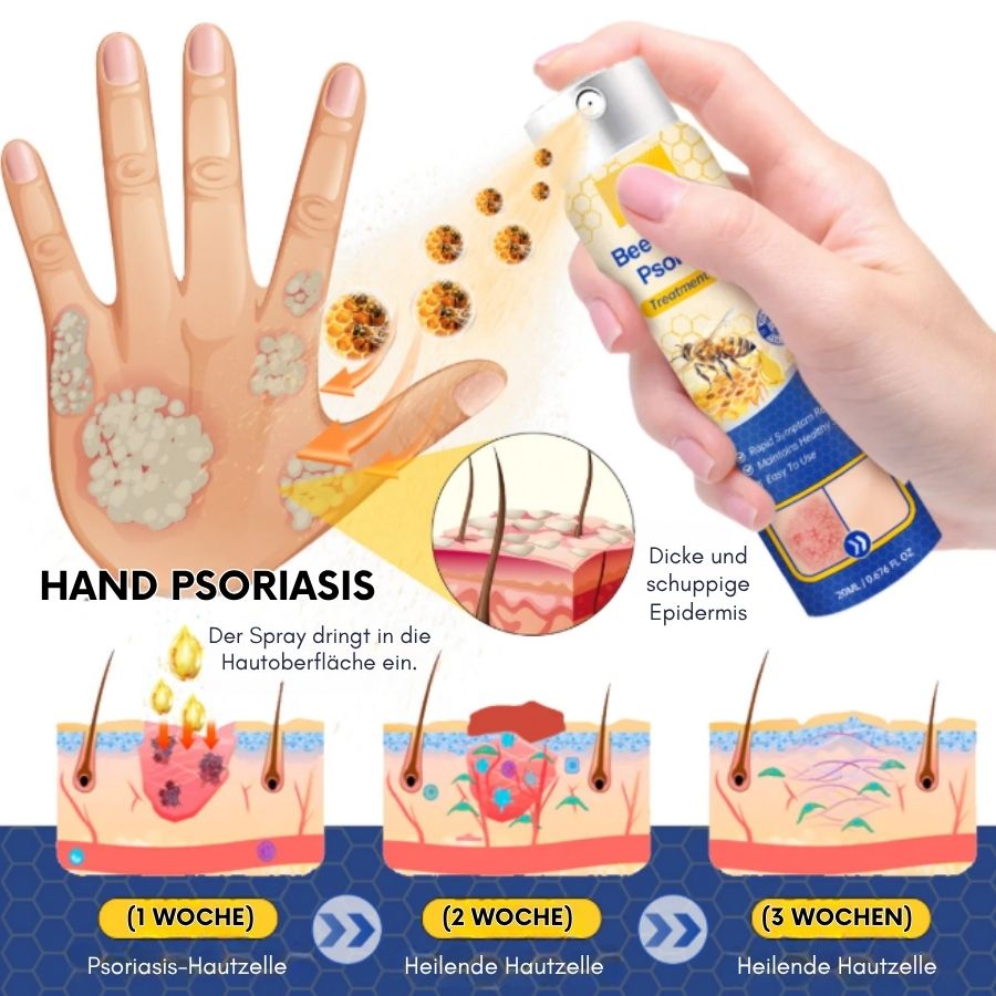 PsoriaFix™ | Bienenvenom Psoriasis Beruhigungsspray