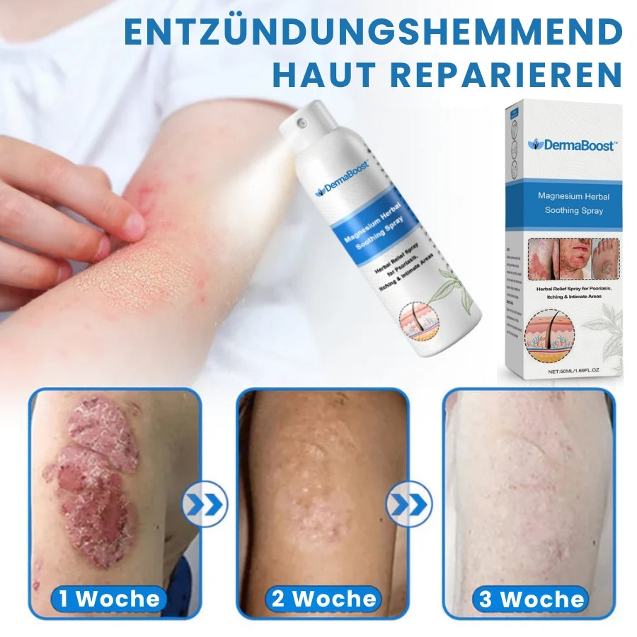 DermaBoost™ | Psoriasis und Ekzem Kräuter‑Beruhigungsspray