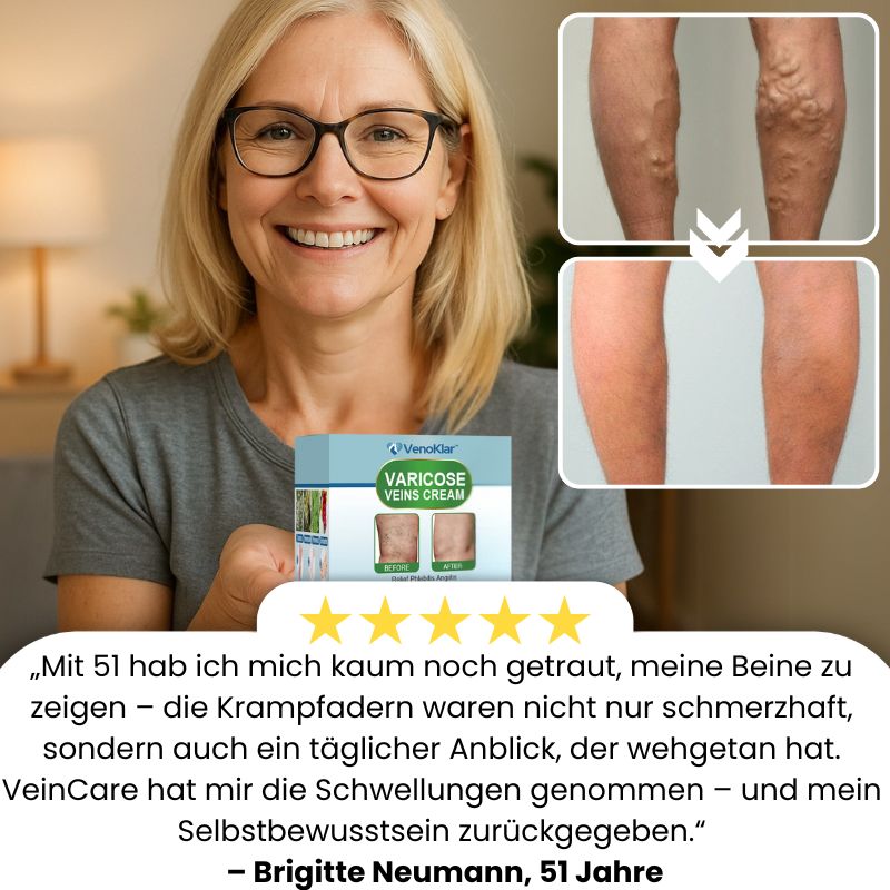VenoKlar™ | Krampfadern- & Besenreiser-Creme