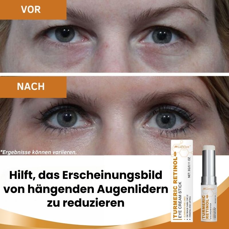 LidVive™ | Augenlid-Lifting-Creme-Stick