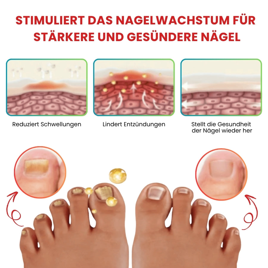 NailZen™ | Hagebuttenöl Nagelbehandlung