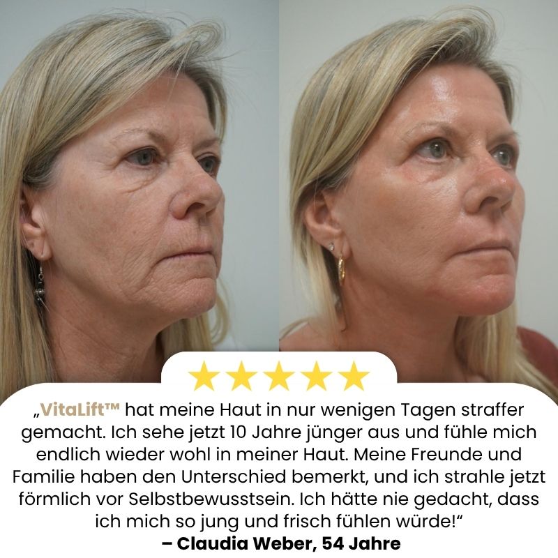 VitaLift™ | Rinderfett für Hautstraffung