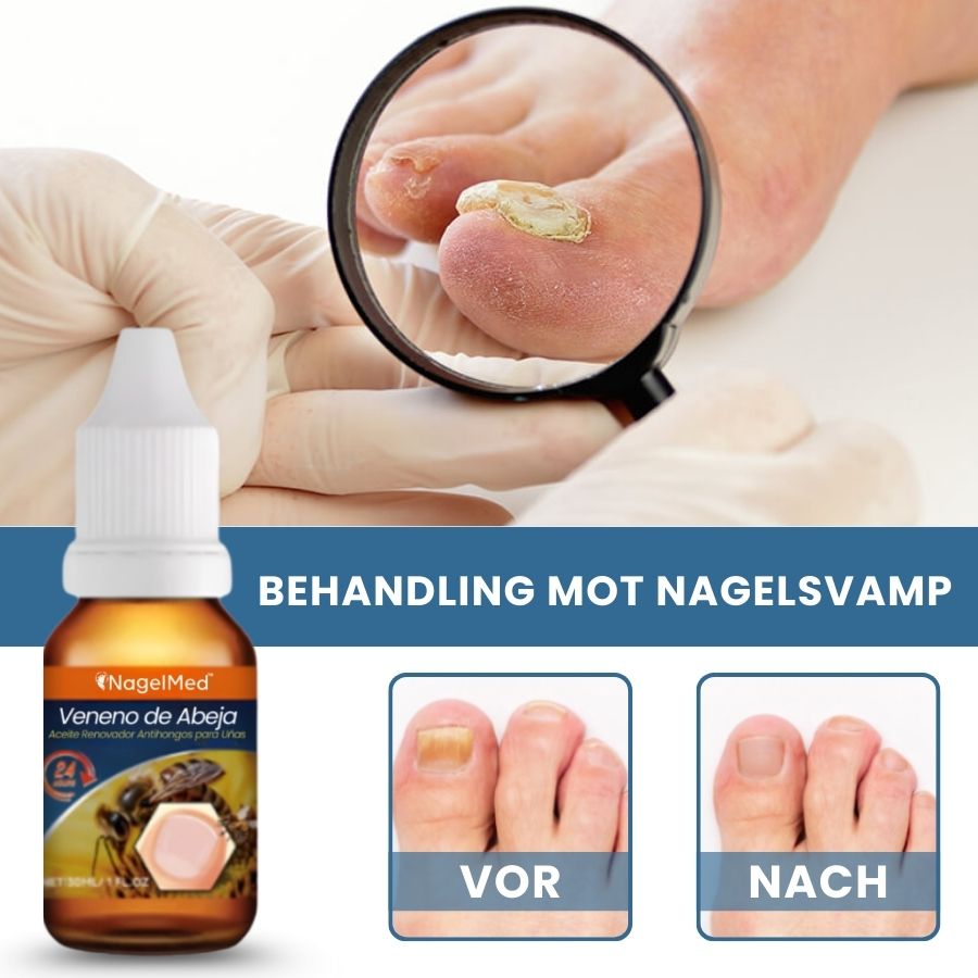 NagelMed™ | Nagelbehandlungs-Serum