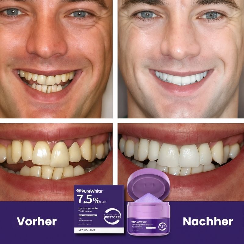 PureWhite™ | Zahnaufhellungs-Kit