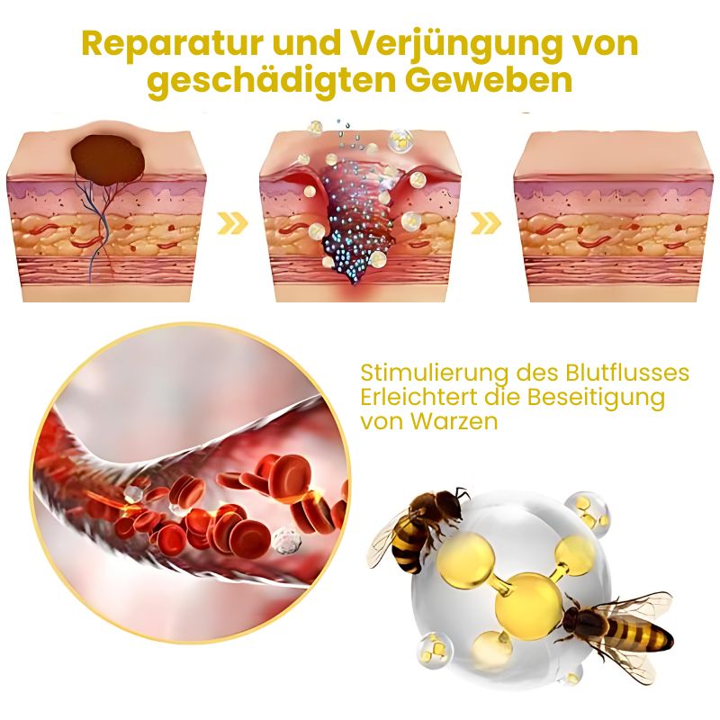 WarzenFix™ | Bienenstich-Reparatur- und Feuchtigkeitscreme