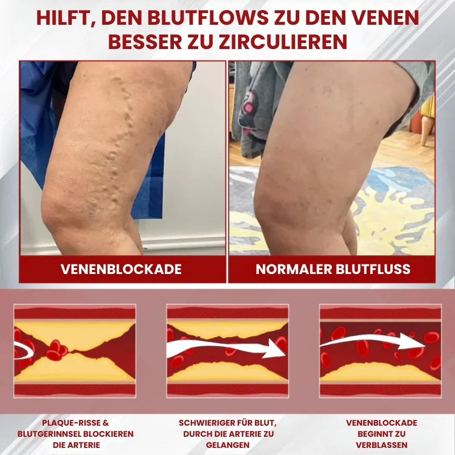 FluidRelief™ | Rote-Weinrebe Ödem Gel