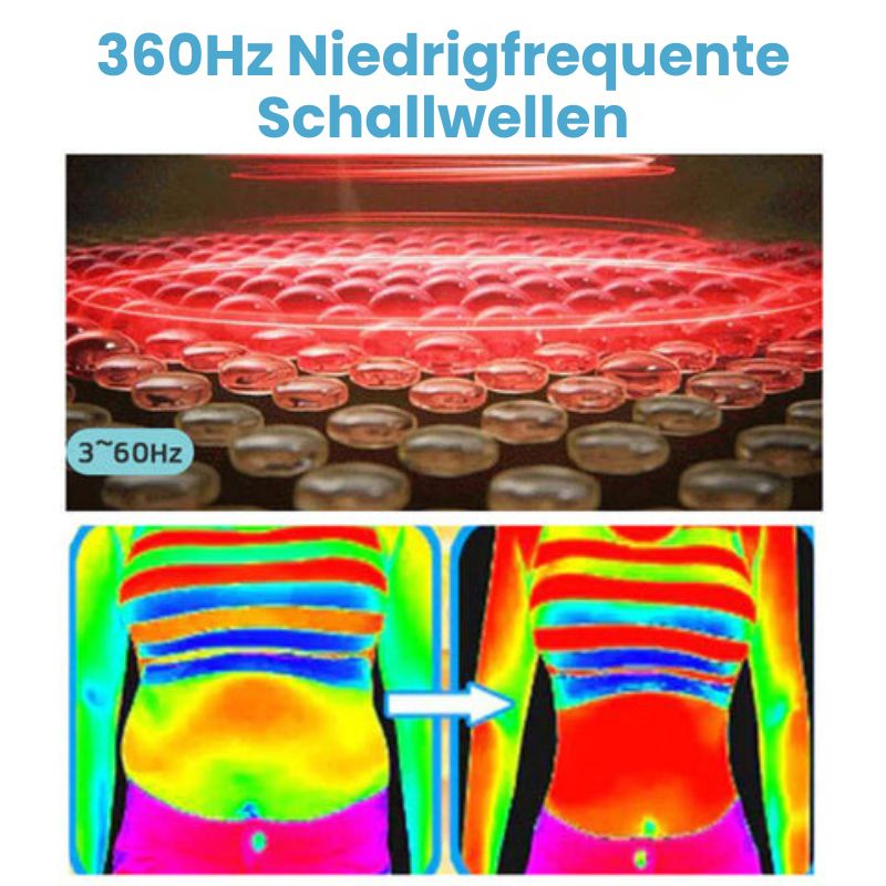 SlimPuls™ | Ultraschall-Detox-Armband für Fettverbrennung & Blutzuckerregulation