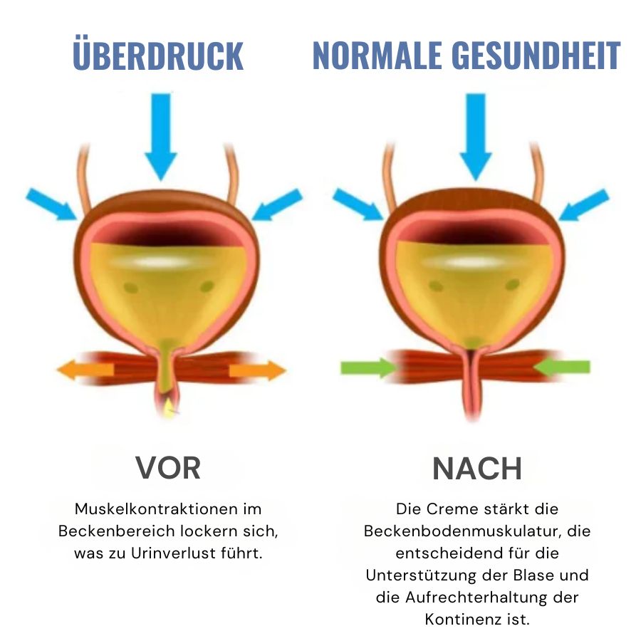 BlaseEase™ | Natürliche Blasenkontroll-Creme