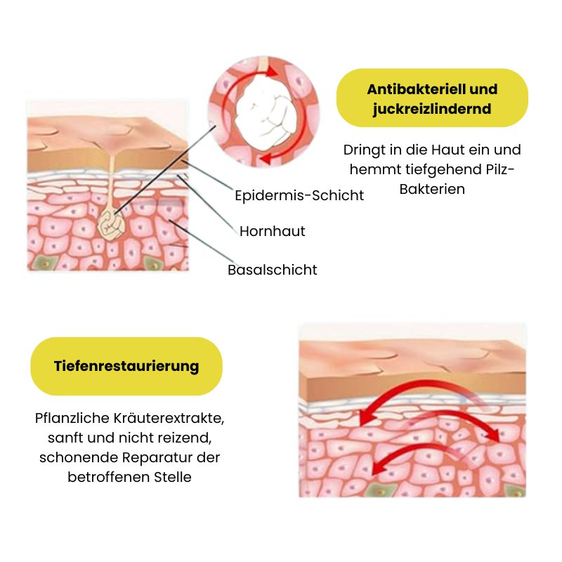HerbaKur™ | Ekzem & Psoriasis Kräutercreme