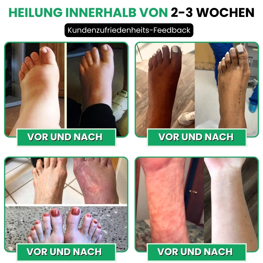 NerveFlex™ | Anti-Neuropathie-Gerät