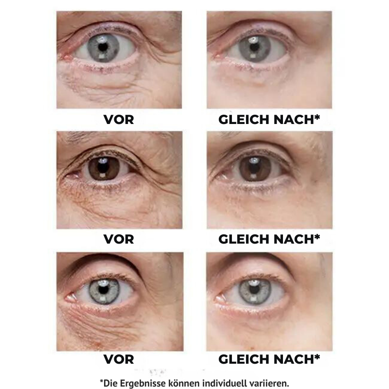 FirmCreme™ | Sofort straffende Creme für faltige Haut in nur 90 Sekunden!
