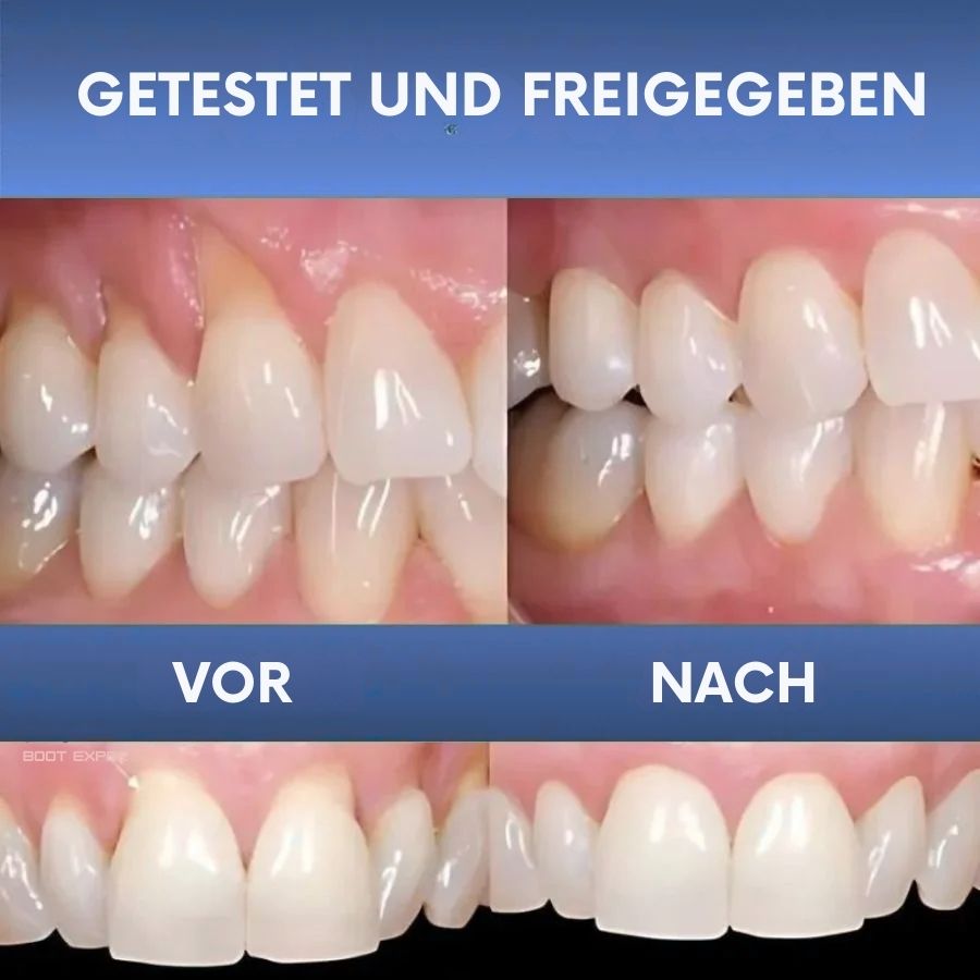 ReGum™ | Zahnfleisch Sofort-Beruhigungs-Gel