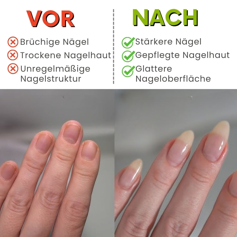 Nailuxe™ | Stammzell-Nagelwachstumsstift