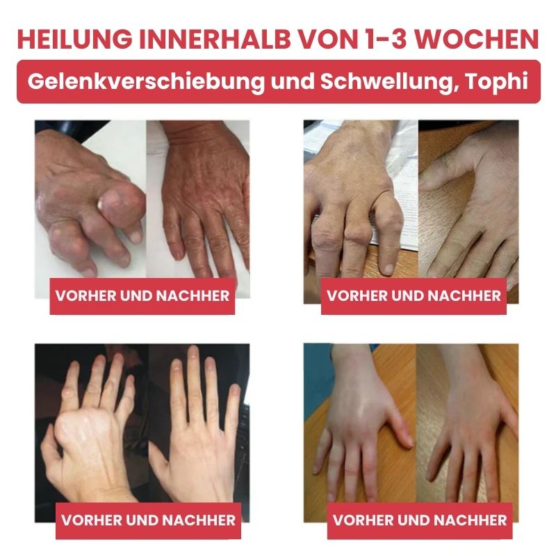 FlexiKühl™ | Schnellwirksames Kühlgel