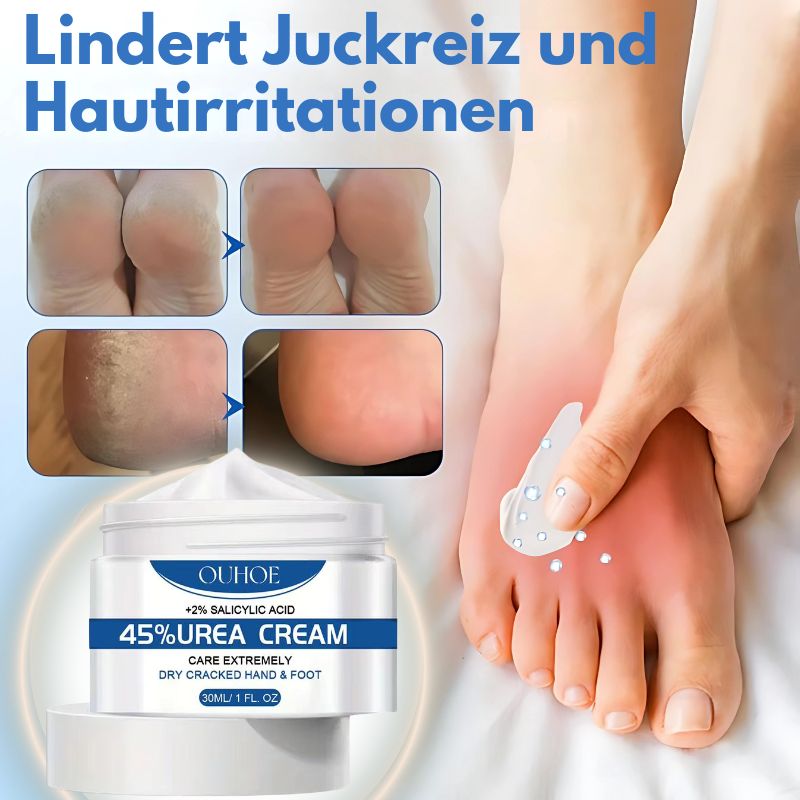 RisshautCreme™ | Creme zur Reparatur rissiger Haut