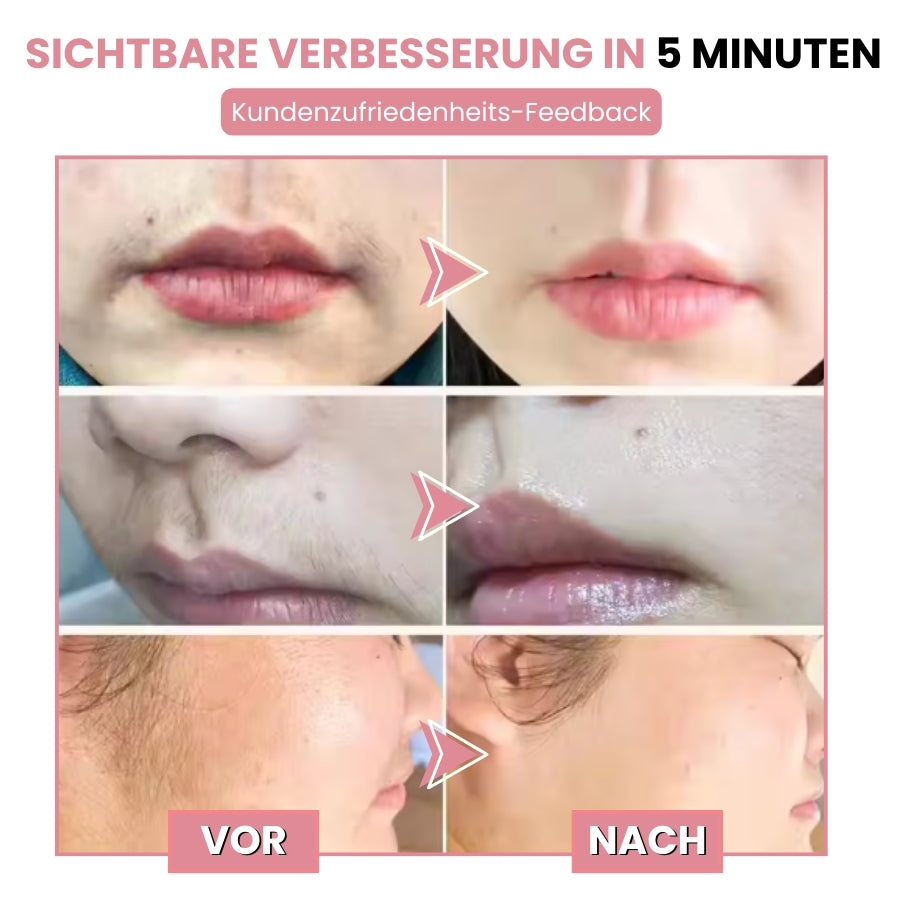 HairSnap™ | Gesichts-Haarentfernungscreme