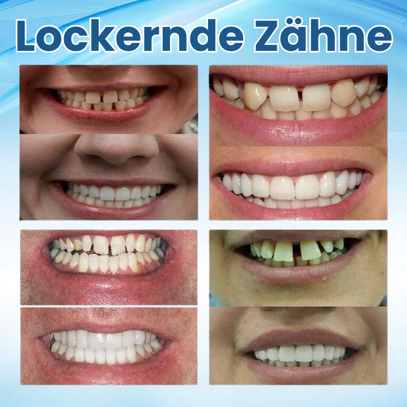 ProthesenFit™ | Sofortprothesen