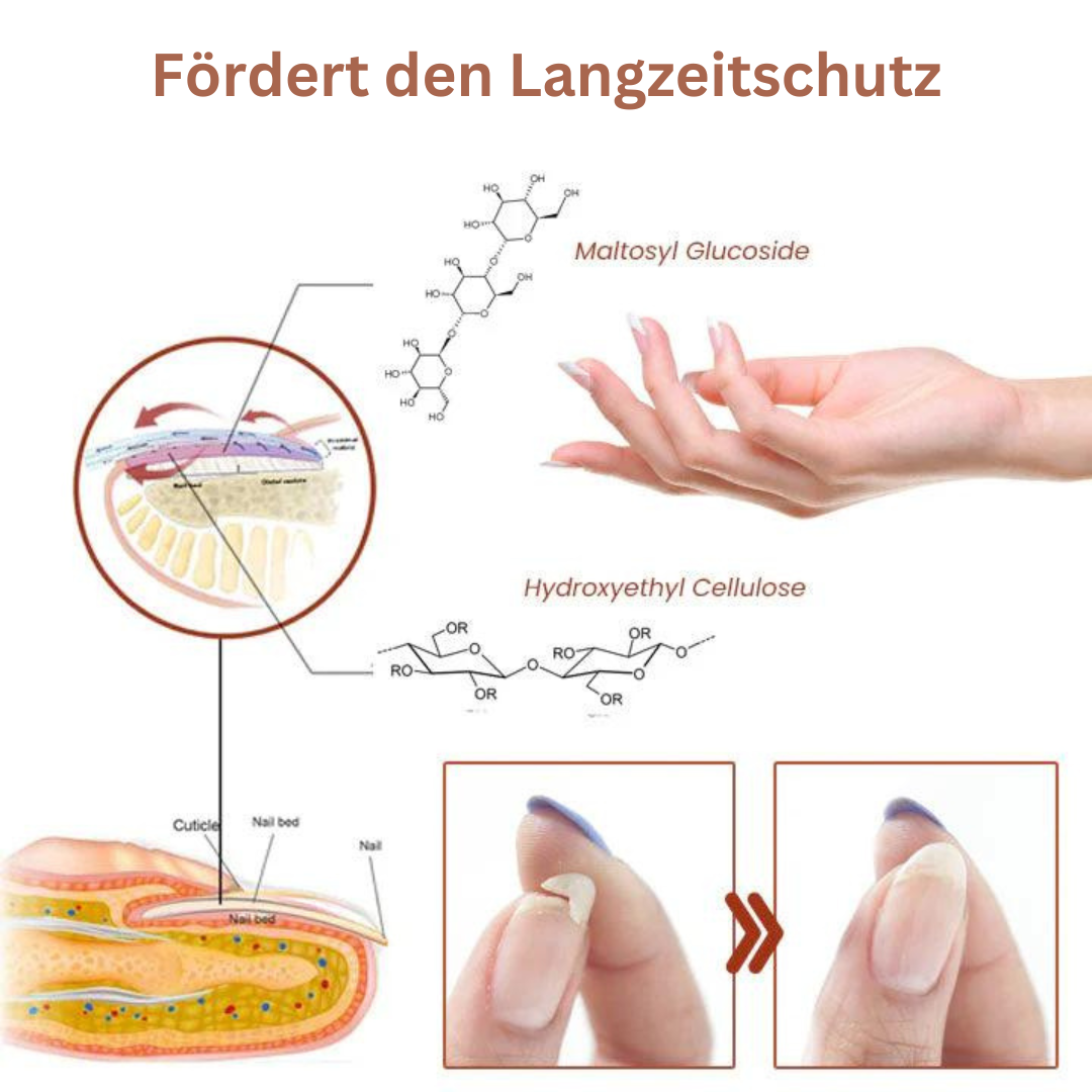 NägelVerstärken | Wiederherstellung und Schutz Ihrer beschädigten Nägel in nur 7 Tagen!