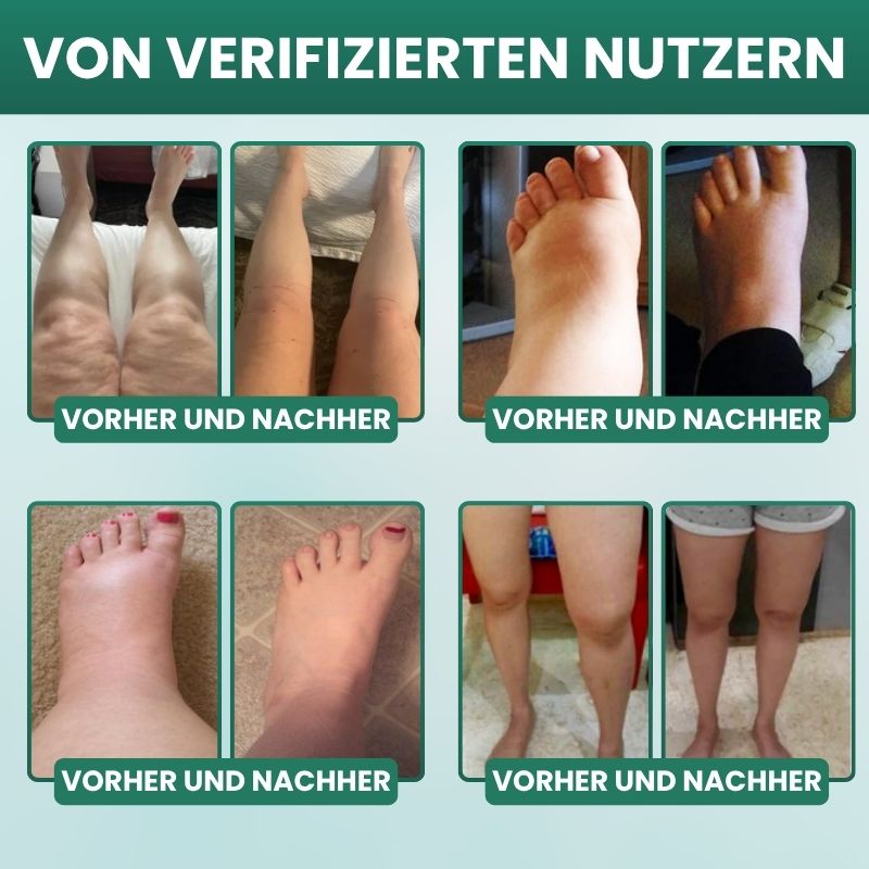 Lymphoria™ | Wellness-Tropfen für die Lymphdrainage