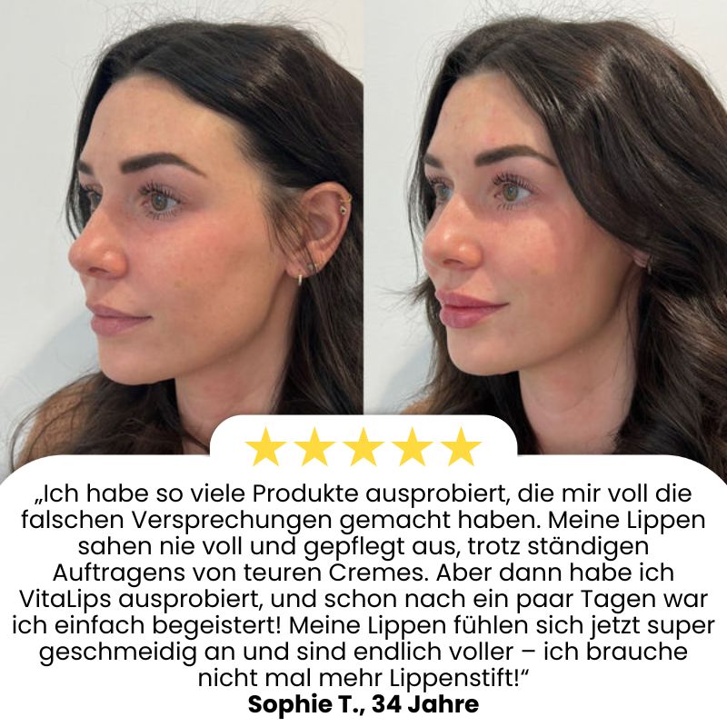 VitaLips® | Lippenserum-Stift