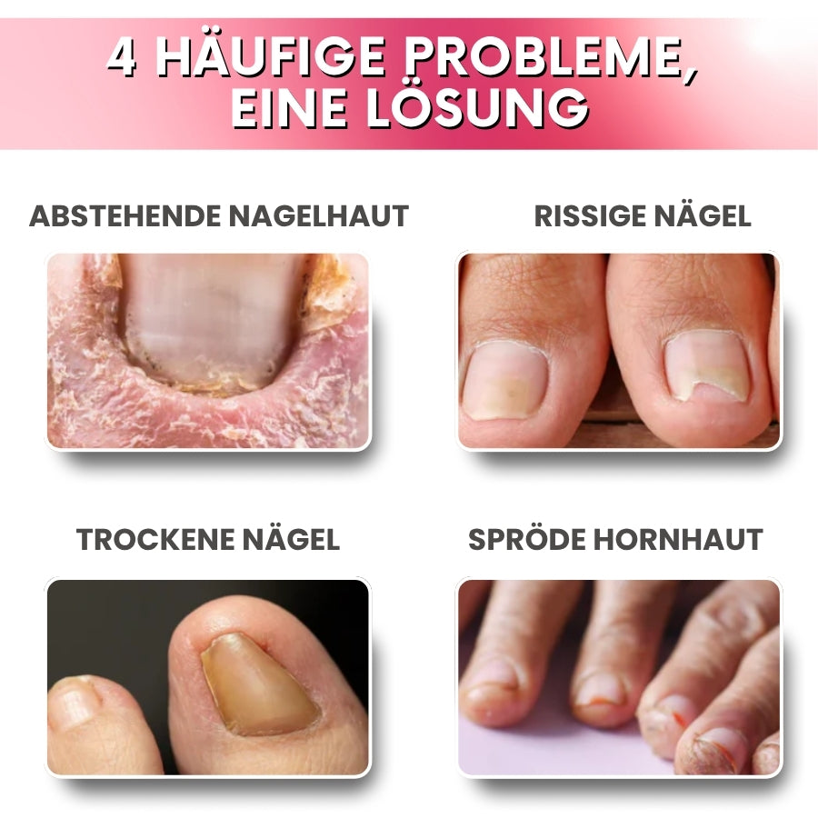Nailuxe™ | Stammzell-Nagelwachstumsstift