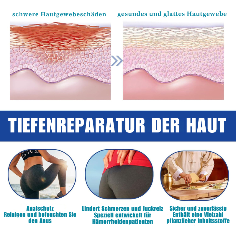 HämPflege™ | Beseitigen Sie Hämorrhoidenleiden in nur 1 Tag!