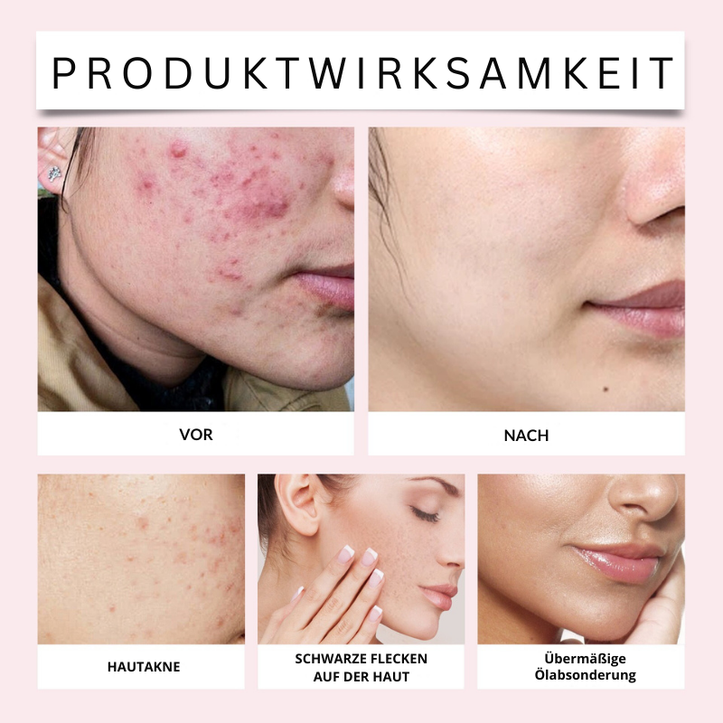 GlanzPads™ | Enthüllen Ihre strahlendere Gesichtshaut in nur 7 Tagen!