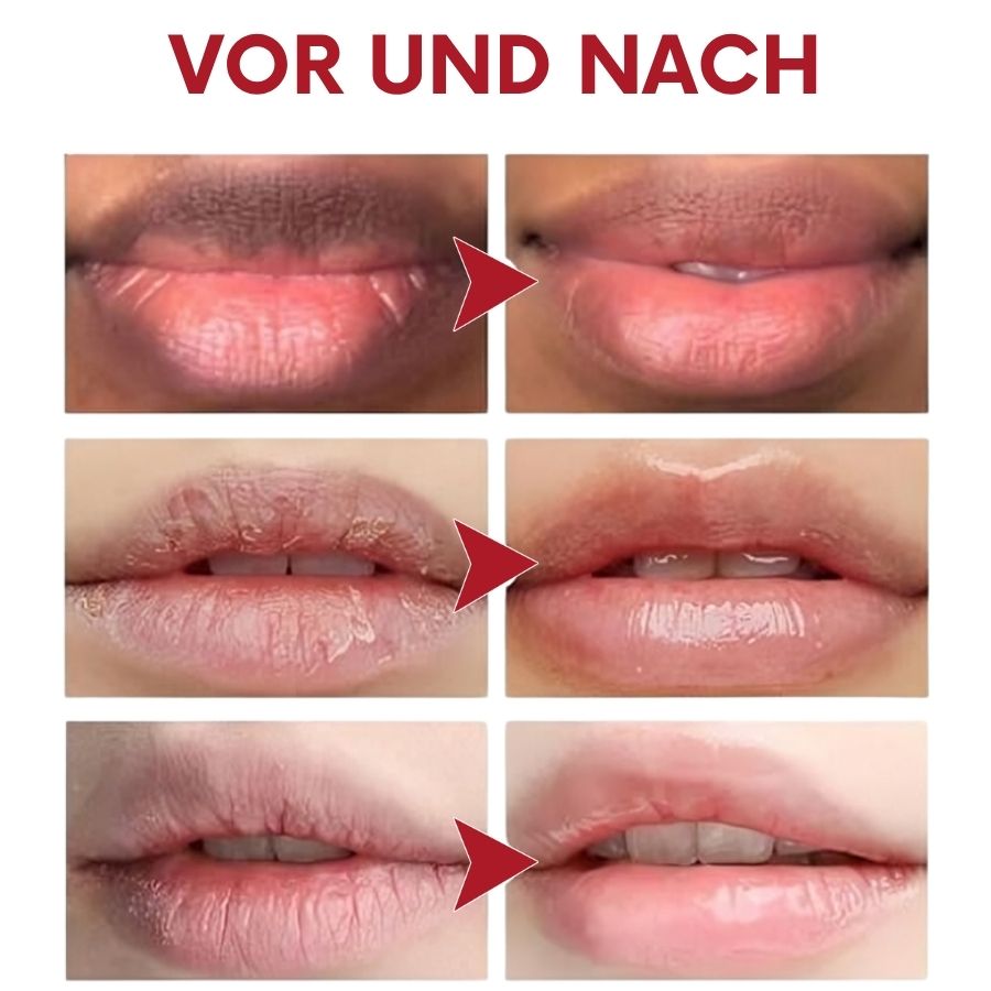 LuxeLip™ | Lippenfalten-Creme