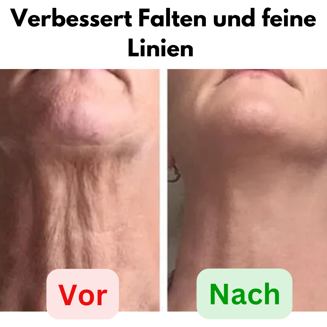 StraffHaut™