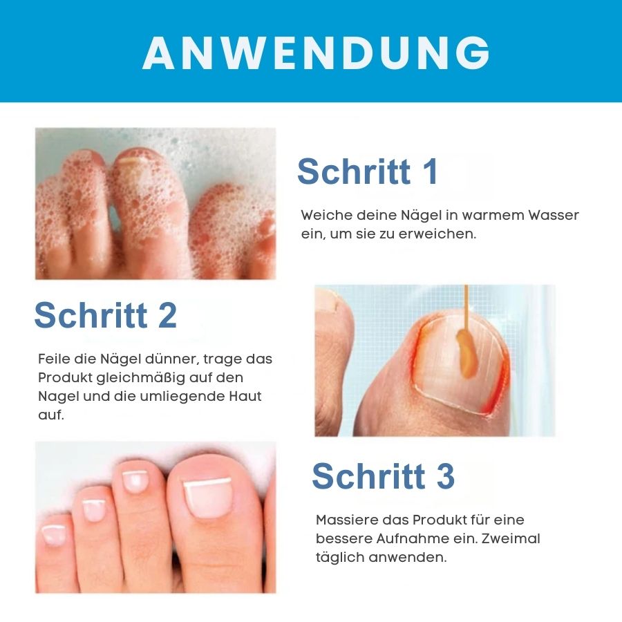 KlarNagel™  | Schnelle Antipilz-Salbe