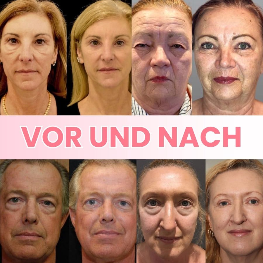 GlowBalm™ | Hagebutten Augenbalsam