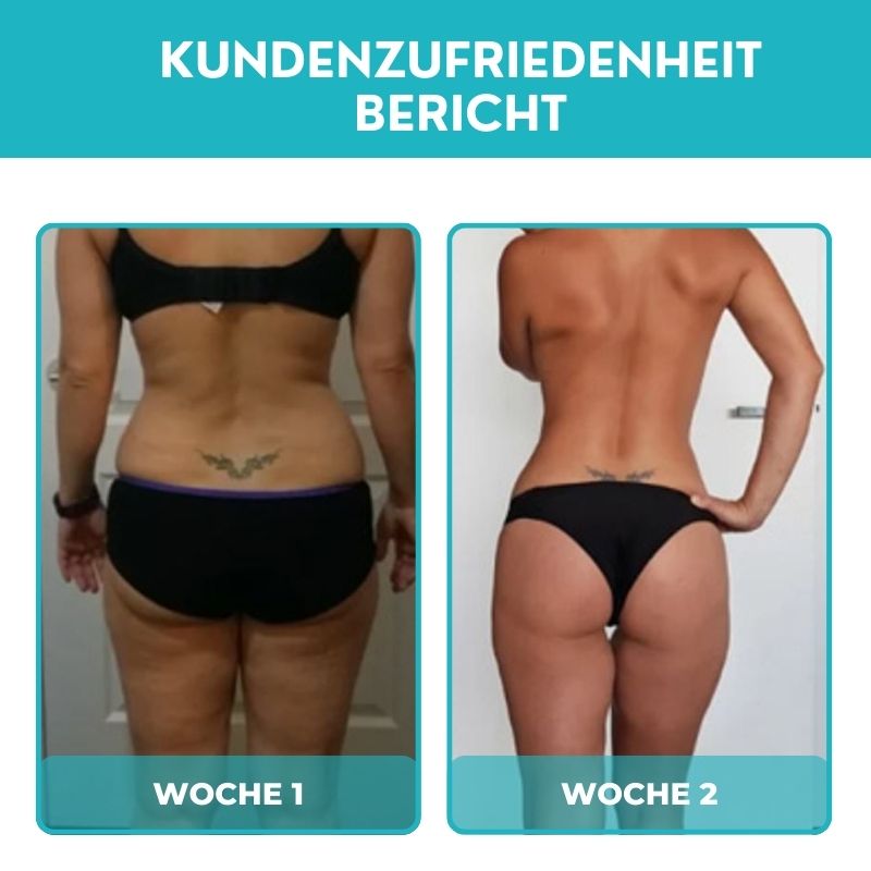 CelluKlar™ | Ultraschall-Bänder zur Cellulite-Entfernung und Entgiftung