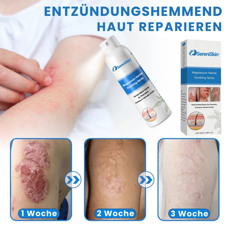 SereniSkin™ | Magnesium Kräuter Beruhigungs-Spray