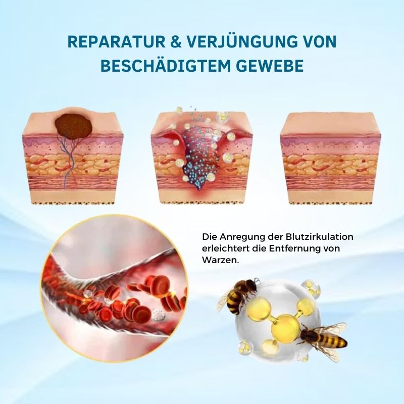 BeeLinderung™ |  Multi-Symptom-Bienengift-Behandlungscreme