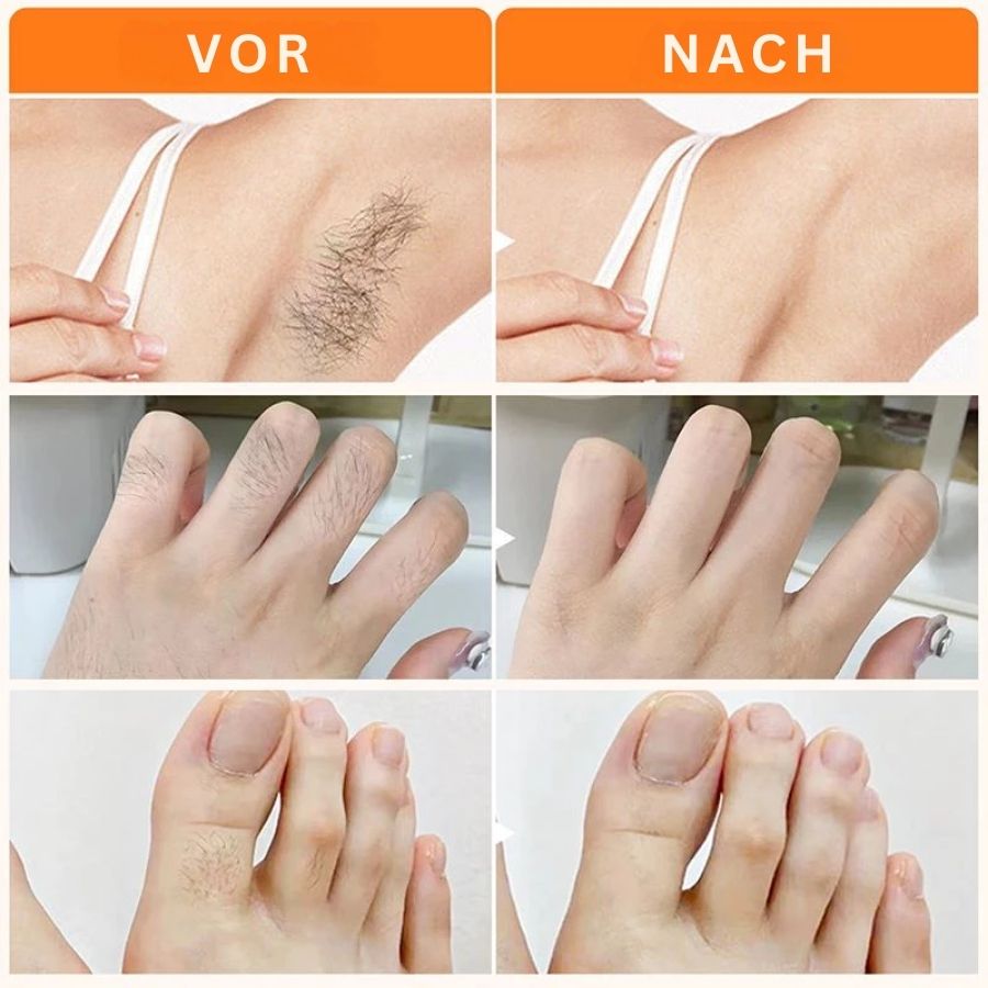 EpiLuxe™ | Haarentfernungscreme für die Oberlippe