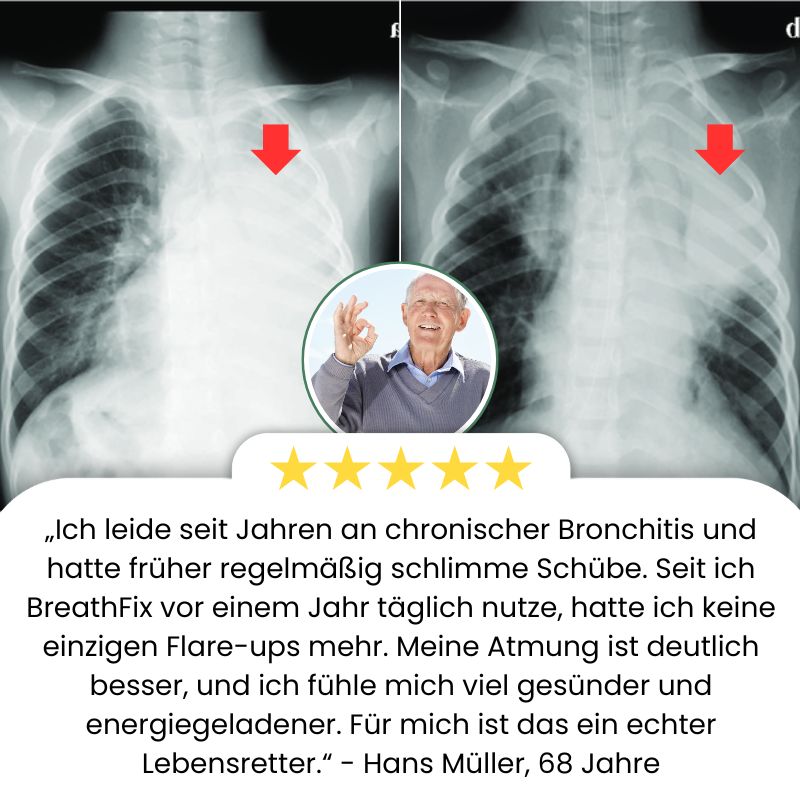 BreathFix™ | Kräuter-Lungenreiniger