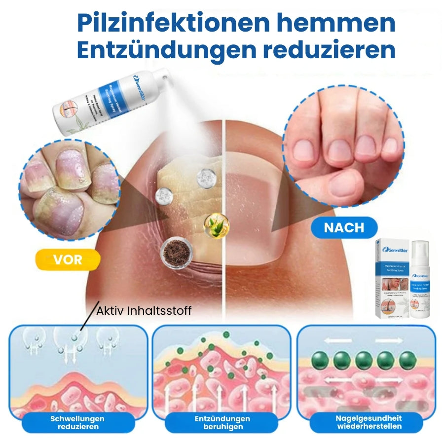 SereniSkin™ | Magnesium Kräuter Beruhigungs-Spray