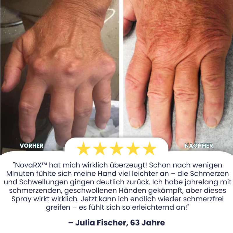 NovaRX™ | Gicht-Linderungs-Spray