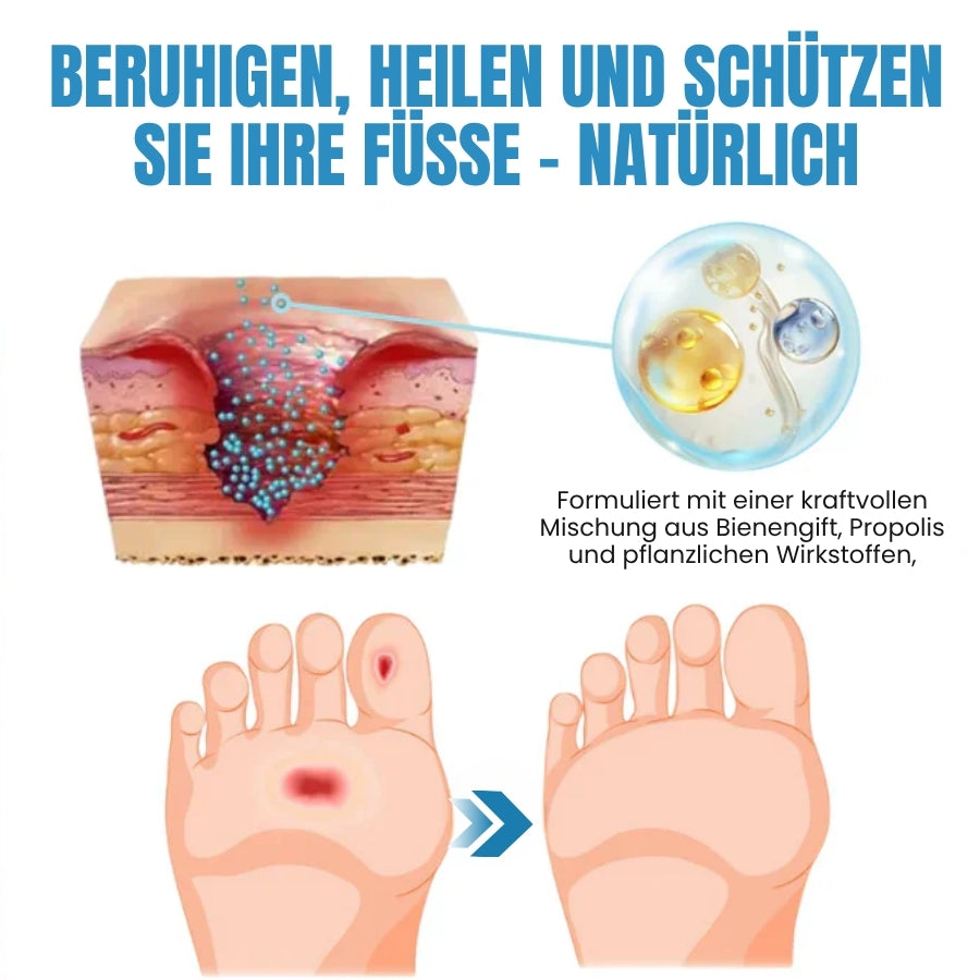 DiaCure™ | VenHeal Bienengift Diabetische Wundspray