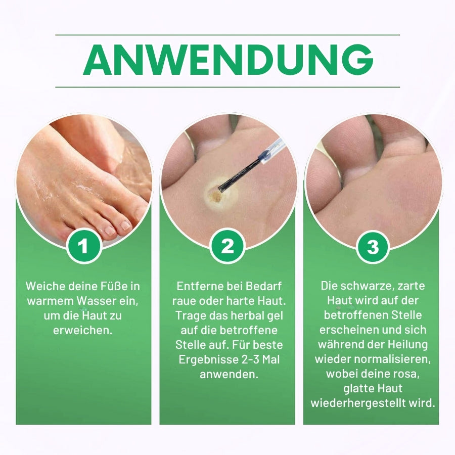 CalluFix™ | Aktives Hornhautentferner-Gel