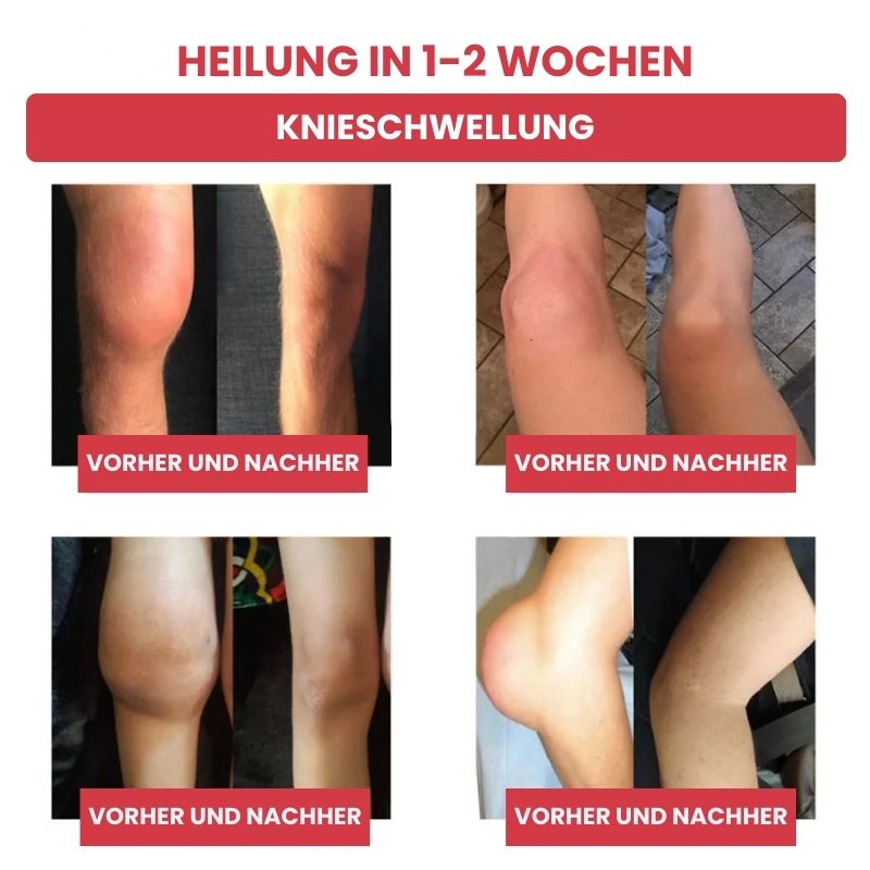 FlexiKühl™ | Schnellwirksames Kühlgel