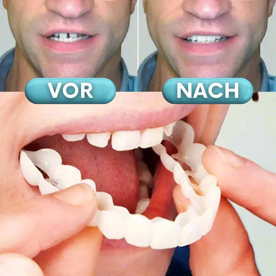 ProDenta™ | Anpassbare Aufsteckprothesen