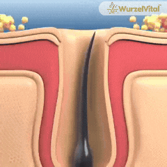 WurzelVital™ | Shampoo für das Nachwachsen der Haarwurzeln