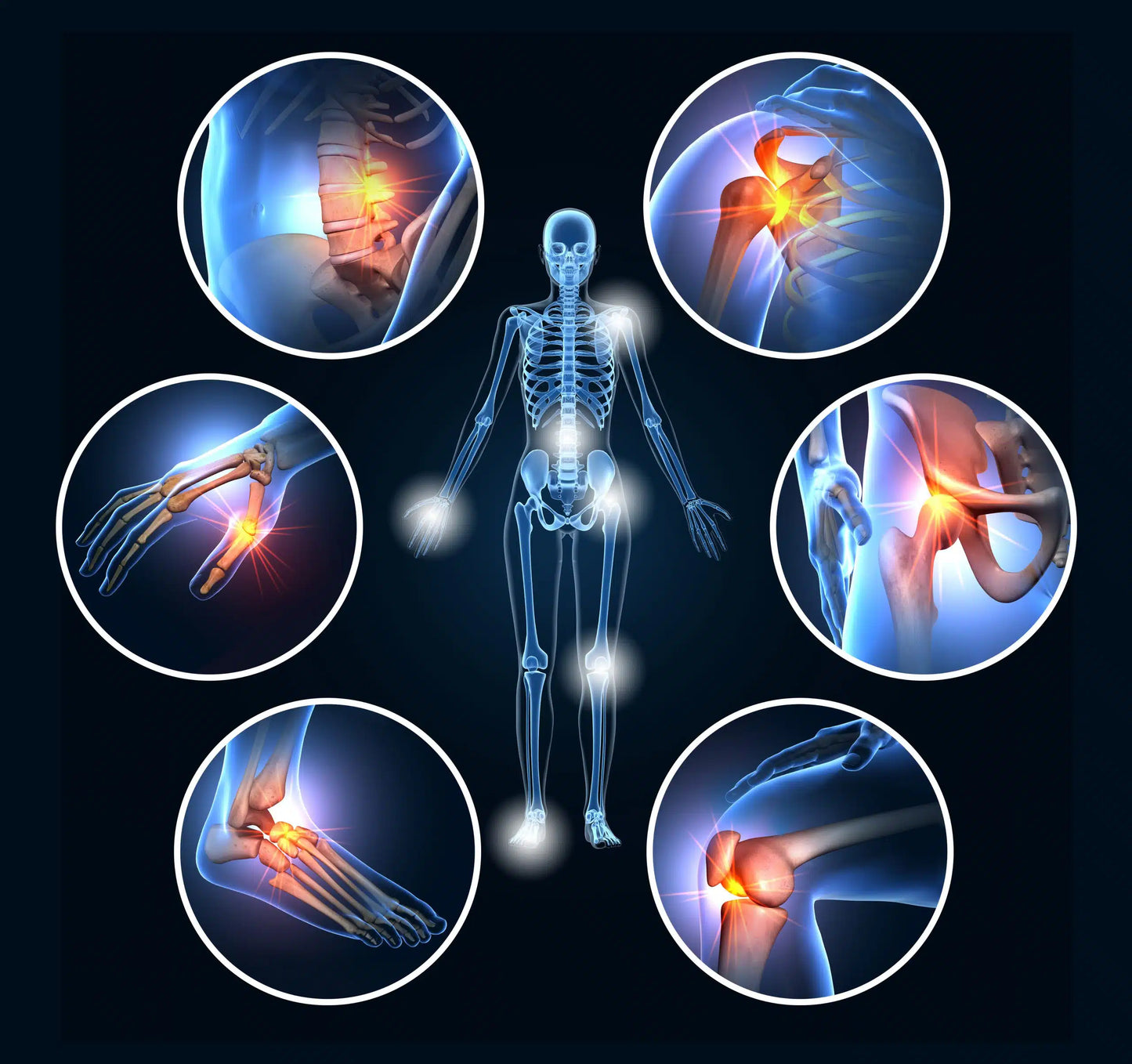 Gelee Flex™ | Umfassende Linderung von Gelenkschmerzen und verbesserte Gelenkgesundheit