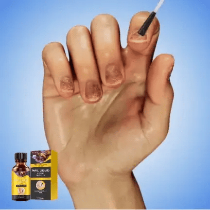 NagelPflege™ | Stellen Ihre hässlichen Nägel in nur 1 Woche wieder her!